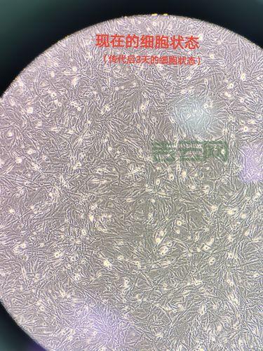 Loadimage加载图片不显示?这几个原因要排查!